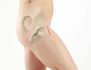 https://www.socaljointreplacement.com/3d-images/anterior-hip-replacement.jpg